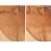 SiO Beauty SkinPad Silicone Chest Anti-Wrinkle Patches - 2 Weeks Supply - Buy Online on SooperMarket.com