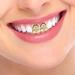 Didiseaon 2pcs Gold Decor Grills Grill Teeth Hip-hop Supplies Props Clothing Men and Women The Cross - Buy Online on SooperMarket.com