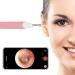 Otoscope 3.9mm Ear Wax Removal Tool Ear Endoscope Ear Scope Ear Inspection Camera with 6 Lights for Kids Adults HD Waterproof Ear Cleaning for Android iPhone (Pink)