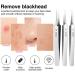 Acne Clip Professional Ultra Fine 5 acne Blackhead Salon Cleansing Acne Needle Clip Skin Deep Beauty Fac Care J9O5 Tweezers Beak Clip - Buy Online on SooperMarket.com