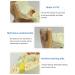 Human Ear Model Professional Ear Simulation Model 6X Magnification Human Organ Model Ear Model 5-Piece Medical Education Model - Buy Online on SooperMarket.com