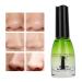 Ultimate Blackhead Removal Kit | Deep Pore Cleanser & Anti-Acne Serum for Face Nose & Chin - 1G - Buy Online on SooperMarket.com