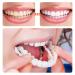 4 PCS Fake Teeth Veneers Dentures Kit for Women and Men - Temporary Dental Veneers for Tooth Repair - Bright White - Protect Your Smile and Boost Confidence - Buy Online on SooperMarket.com