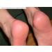 Natural Products Black Callus Ex - Effective Callus Remover & Foot Cream 50ml | Best Foot Care Solution - Buy Online on SooperMarket.com