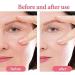 Silicone Facial Wrinkle Plaster Reusable Beauty Skin Firming Wrinkle Smoothing Plaster - Buy Online on SooperMarket.com