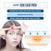 Epielle Acne Clear Patch - Hydrocolloid Pimple Patch for Face & Skin, 4 Pack Acne Spot Treatment Stickers - Cruelty-Free, Two Patch Sizes 8mm & 10mm - Buy Online on SooperMarket.com