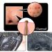 SHILLS Purifying Pore Strips - 28 Count Deep Cleansing Blackhead Remover Combo Pack - Buy Online on SooperMarket.com