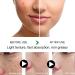 Dark Spot Remover for Face & Body Dark Spot Corrector Cream Age Spot Remover for Face Spot Cream Dark Spot Corrector Freckle Remover Cream Dark Spot Correcting Glow Serum Dark Spots Remover 20 g - Buy Online on SooperMarket.com