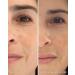 Then I Met You Ros Resurfacing Facial Mask - Nourishing AHA BHA Treatment | Vegan Brightening Skincare - Buy Online on SooperMarket.com