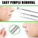 Blackhead Remover Tool Kit - 5-in-1 Stainless Steel Pimple Popper Extractor Set for Face with 4 Tweezers - 0414043 - Buy Online on SooperMarket.com
