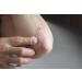 Blure 5% Urea Cream - Dry Skin & Psoriasis Relief | Itch & Rash Care | 100ml Airless Pump - Buy Online on SooperMarket.com