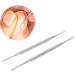 Ingrown Toenail File Ingrown Toenail Cleaner Ergonomic Safe Professional Salon Stainless Steel - Buy Online on SooperMarket.com