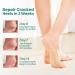 Welnove Moisturizing Heel Socks Aloe Vera Infused Gel for Dry Feet & Cracked Heels 2 Pairs Cotton Foot Care Socks for Men & Women Blue Regular Size - Buy Online on SooperMarket.com