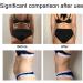 Anggrek Body Lipo Patch: Abdomen Lift Tapes for Firming, Slimming & Cellulite Reduction - Buy Online on SooperMarket.com