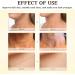 Neck Firming Cream Bee-Venom Neck Cream Stick Skin Tightening Cream Body Anti Wrinkle Cream Anti Aging Moisturising & Nourishing Lifting Smooth Neck Lines Night Cream For Women - Buy Online on SooperMarket.com