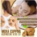 Moxa Cupping Acupuncture Detox Set - 2022 Best Moxa Stick Acupoint Massage Smoke Free Moxibustion Cupping Therapy Set Reusable Moxibustion Tube Improve Your Health - Buy Online on SooperMarket.com