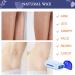 Roll on Waxing Kit for Women - Warmer & Roller for Hair Removal on Larger Body Areas | Includes 2 Wax, 100 Strips & Blue Roll - Buy Online on SooperMarket.com