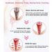 Anniecare Natural Repair Vaginal Capsule | Instant Anti-Itch & Tighten | 4PCS - Buy Online on SooperMarket.com
