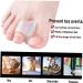 Pinicecore 2ST Toe Silicone Bunion Protection | Orthopedic Toe Spreader & Separator for Foot Care - Buy Online on SooperMarket.com