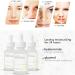 EHIOG niacinamide serum the ordinary Facial Serum Pore Reducer for Shrinking Enlarged Pores Hydrating Skin and Balancing Sebum Production for Women and Men (30ml) - Buy Online on SooperMarket.com