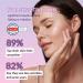 High Strength Retinol Serum - 2 5% Retinol Anti-Ageing Formula with Hyaluronic Acid and Witch Hazel - 30ml - Intensive Face Care against Wrinkles and Age Spots - Buy Online on SooperMarket.com