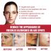Dajidafu Women Face Whitening Brightening Girls Natural Ingredient Moisturizing Essence Female Portable Stock Solution - Buy Online on SooperMarket.com