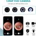 Ear Wax Removal Kit with Camera for Phones - Ear Cleaner Tools Set - White - Buy Online on SooperMarket.com