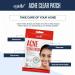 Epielle Acne Clear Patch - Hydrocolloid Pimple Patch for Face & Skin, 4 Pack Acne Spot Treatment Stickers - Cruelty-Free, Two Patch Sizes 8mm & 10mm - Buy Online on SooperMarket.com