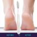 Toseky Foot Rasp Foot File - Reusable Stainless Steel Cracked Skin Removal Tool | Foot File Foot ScrubberStainless Steel Cracked Skin Removal File Brush Tools for Foot Scrubbing White - Buy Online on SooperMarket.com