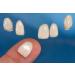 Ultra Thin Tooth Whitening Veneers for Missing or Broken Teeth | Realistic Cosmetically Enhanced Smile | Shade A-2 - Buy Online on SooperMarket.com