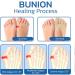 Projoint Antibunions Health Socks - Bunion Relief & Corrector (4 Pair) - Buy Online on SooperMarket.com