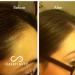 Hairfinity Infinite Edges Hair Serum - Hair Growth Treatment for Alopecia - Stimulates Hair Follicles, Prevents Hair Loss, and Promotes Regrowth - Sulfate & Silicone Free - Buy Online on SooperMarket.com