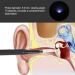 Earwax Removal Kit with Camera | Home Ear Cleaning Tool - Buy Online on SooperMarket.com