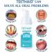 Teethaid Mouthwash & Whitening Toothpaste Foam - Heal Ulcers Freshen Breath Prevent Caries (2 Pack) - Buy Online on SooperMarket.com