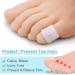 Gel Toe Cap and Protector - Prevent Ingrown Toenails, Corns, Blisters, Hammer Toes - 8 Pairs - Buy Online on SooperMarket.com