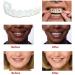 Fake Teeth Veneers Dentures - Cosmetic Tooth Repair Kit for Men and Women | Protect Your Teeth and Regain Confidence - Buy Online on SooperMarket.com