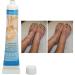 Vitiligo Cream 30G - Herbal Extract Treatment for White Spots & Skin Pigmentation - Creme Medix Leukoplakia Solution - 0.7oz - Buy Online on SooperMarket.com