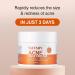 Salicylic Acid Acne Treatment Cream for Face & Body - Teens & Adults | Anti-Acne Moisturizer & Spot Treatment - Buy Online on SooperMarket.com