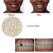 2pcs 50g False Teeth Solid Glue Kit - Temporary Tooth Replacement & Repair Adhesive - Buy Online on SooperMarket.com