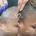 Hairfinity Infinite Edges Hair Serum - Hair Growth Treatment for Alopecia - Stimulates Hair Follicles, Prevents Hair Loss, and Promotes Regrowth - Sulfate & Silicone Free - Buy Online on SooperMarket.com
