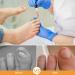Ingrown Toenail Treatment - Ingrown Toenail Pain Reliever and Softener Kit for Easy Trimming with Silicone Gel Toe Caps Clear - Buy Online on SooperMarket.com