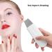 Skin Scrubber Blackhead Removal Exfoliating Facial Spatula for Deep Cleansing - Buy Online on SooperMarket.com