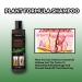 Eczema Psoriasis Anti Dandruff Shampoo for Soothing Dry, Itchy Scalp (200ml) - Buy Online on SooperMarket.com