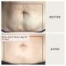 Buy Dermaclara Silicone Stretch Marks Patch Kit - Effective One Patch Solution for Scars | International Shipping Available - Buy Online on SooperMarket.com