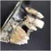 Implant Tooth Template | Oral Simulation Dental Study Model for Teaching - Shop Internationally - Buy Online on SooperMarket.com