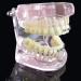 LBYLYH Orthodontic Demonstration Model - Teeth Teaching Tools with Metal & Ceramic Support for Effective Dental Treatment - Buy Online on SooperMarket.com