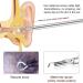 Jteremy 3.9mm HD WiFi Ear Endoscope for Ear Wax Removal - Visual Inspection Camera with LED Lights for Kids, Adults, Pets - Buy Online on SooperMarket.com