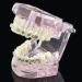 LBYLYH Orthodontic Demonstration Model - Teeth Teaching Tools with Metal & Ceramic Support for Effective Dental Treatment - Buy Online on SooperMarket.com