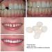 2pcs 50g False Teeth Solid Glue Kit - Temporary Tooth Replacement & Repair Adhesive - Buy Online on SooperMarket.com