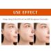 Salicylic Acid Acne Treatment Cream for Face & Body - Teens & Adults | Anti-Acne Moisturizer & Spot Treatment - Buy Online on SooperMarket.com